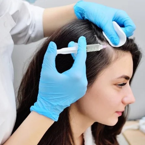 PRP Treatment